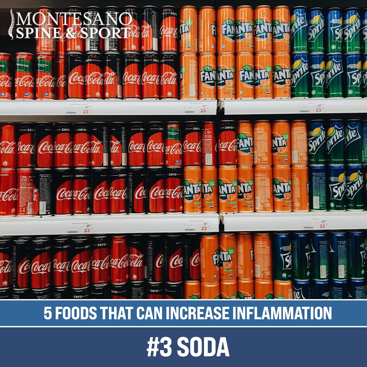 Read more about the article #3 Soda