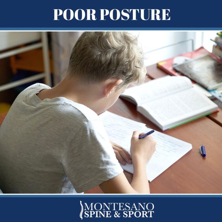 Read more about the article Poor Posture