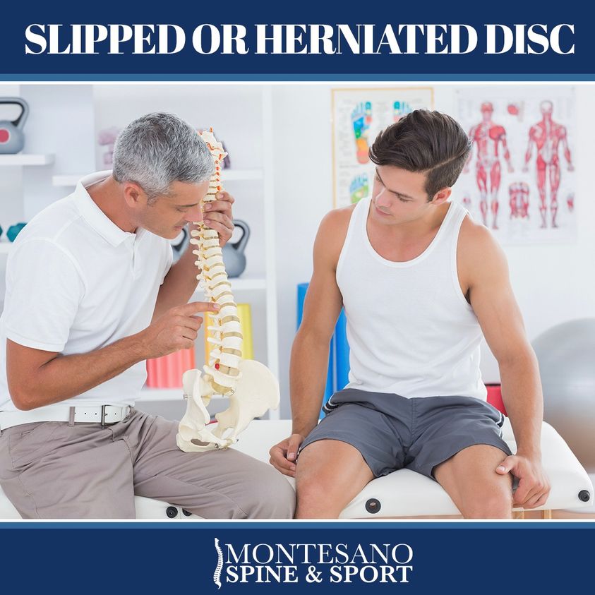You are currently viewing Do you have a slipped disc or herniated disk?